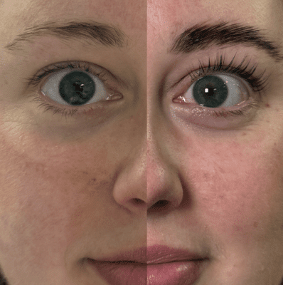 YUMI 3.0 lash lift before and after at Primp & Proper Vancouver