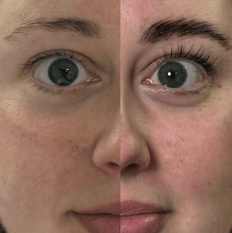 YUMI 3.0 lash lift before and after at Primp & Proper Vancouver